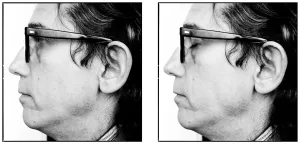 Christo, Eyes Open / Christo, Eyes Shut